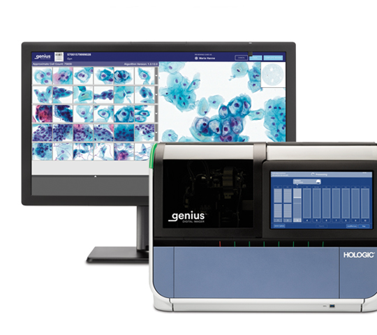 Sistema de diagnóstico digital Genius™ de Hologic sobre fondo blanco