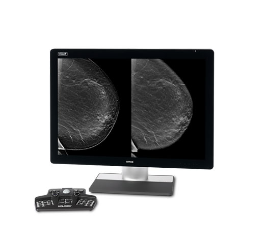 Tecnología de adquisición de imagen Intelligent 2D™ de Hologic sobre fondo blanco