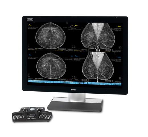 Estación de trabajo de mamografía SecurView® de Hologic sobre fondo blanco