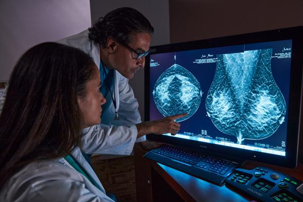 Radiólogos revisando una mamografía con tomosíntesis en una pantalla