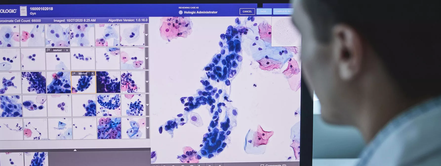 Imagen del sistema de diagnóstico digital Genius™