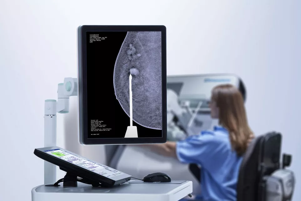 Mamografía 3D con contraste en la pantalla de un ordenador