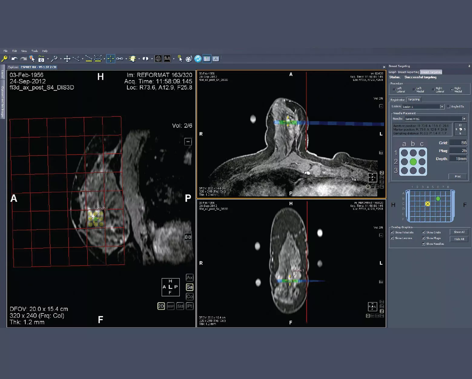 Captura de pantalla de MultiView
