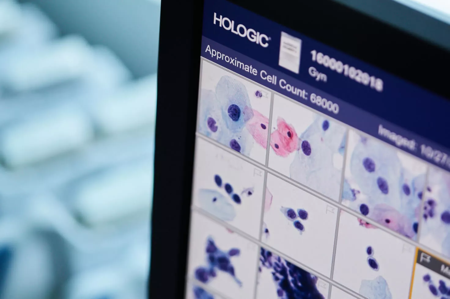 Primer plano de una pantalla llena de imágenes para diagnóstico, con el logotipo de Hologic en una esquina