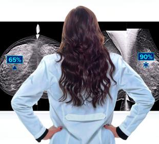 Tecnología de detección Genius AI™ de Hologic sobre fondo blanco