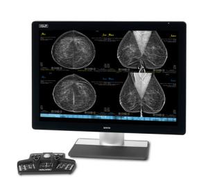 Estación de trabajo de mamografía SecurView® de Hologic sobre fondo blanco