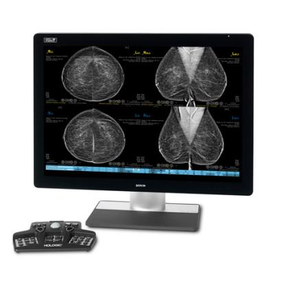 Estación de trabajo de mamografía SecurView® de Hologic sobre fondo blanco